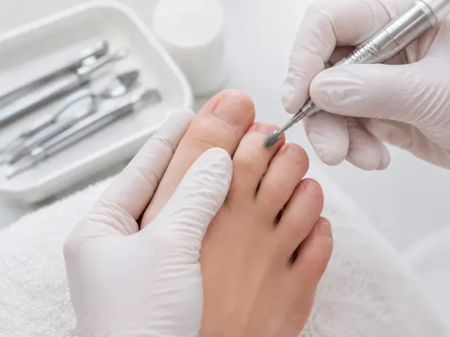 Podolog provádí podologickou pedikúru v ordinaci